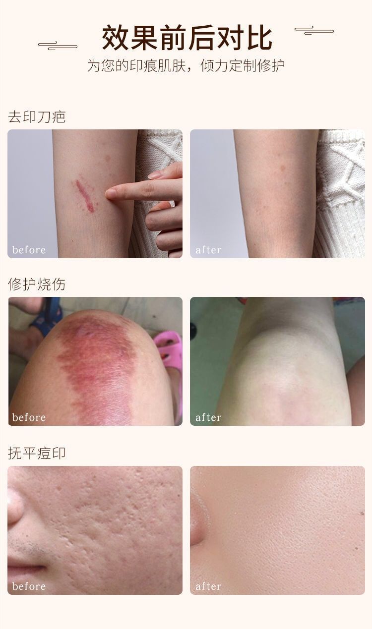 b093dde5-5cea-4379-8aff-2e2f8f93c2c6.jpg.a.jpeg