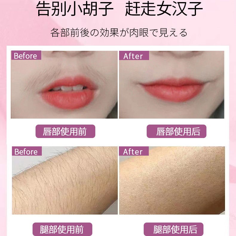 无痛脱毛网红脱毛膏全身温和不刺激脱毛男女 可无毛 不在长去腋毛去腿毛手臂全身不留黑点脱毛神器