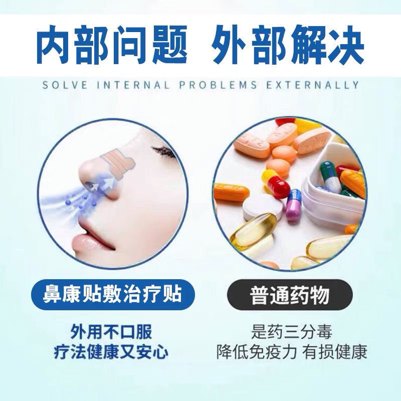 正品鼻炎贴特效穴位贴 过敏性鼻炎克星鼻窦炎鼻塞通鼻子不通气 特效鼻炎贴鼻息肉克星神器