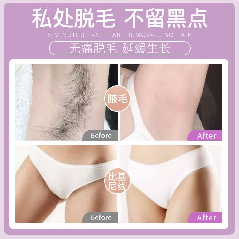 私处脱毛膏女士专用去脱私密处阴毛 比基尼腋下肛毛全身男女学生脱毛膏永久腿毛全身神器