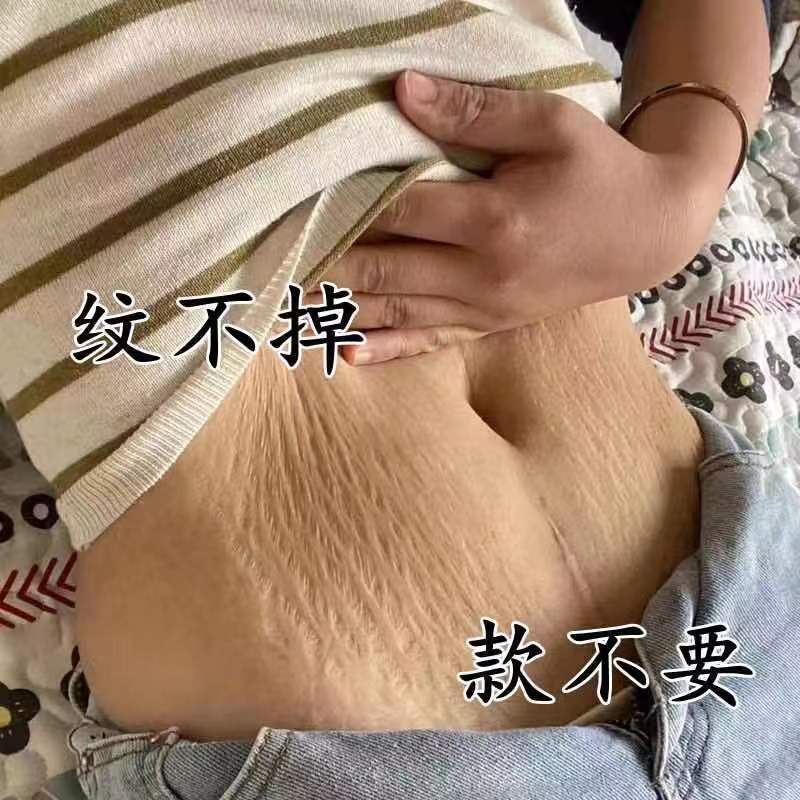 去妊娠纹产后修复霜 老婆去疤膏淡化强效肥胖纹修复膏大腿消除屁股胸纹 孕妇专用紧致肚皮产前预防消除生长纹