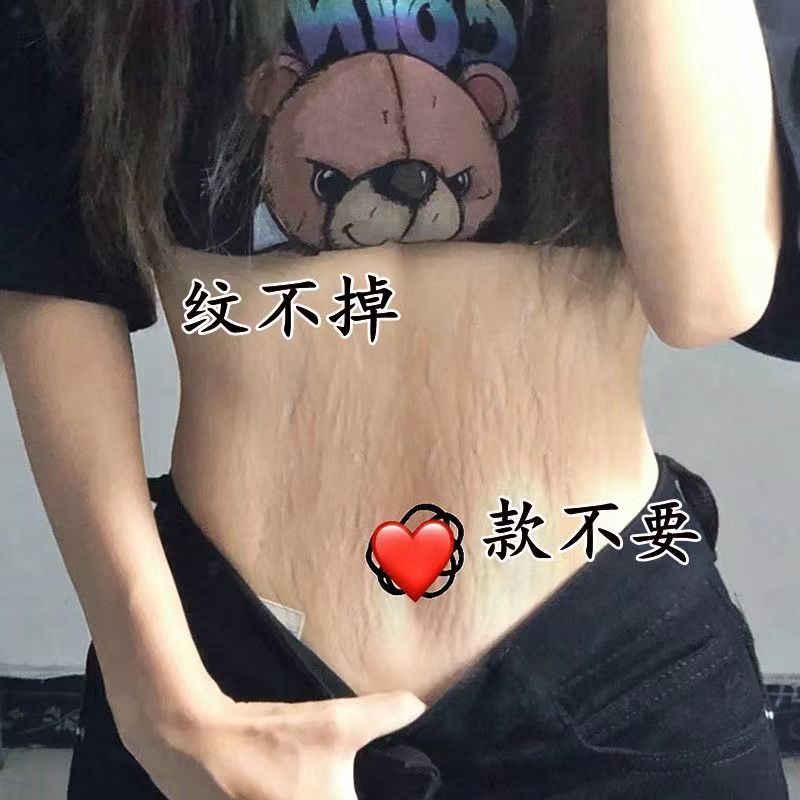 去妊娠纹产后修复霜 老婆去疤膏淡化强效肥胖纹修复膏大腿消除屁股胸纹 孕妇专用紧致肚皮产前预防消除生长纹