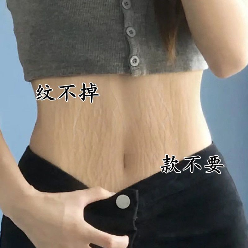 去妊娠纹产后修复霜 老婆去疤膏淡化强效肥胖纹修复膏大腿消除屁股胸纹 孕妇专用紧致肚皮产前预防消除生长纹