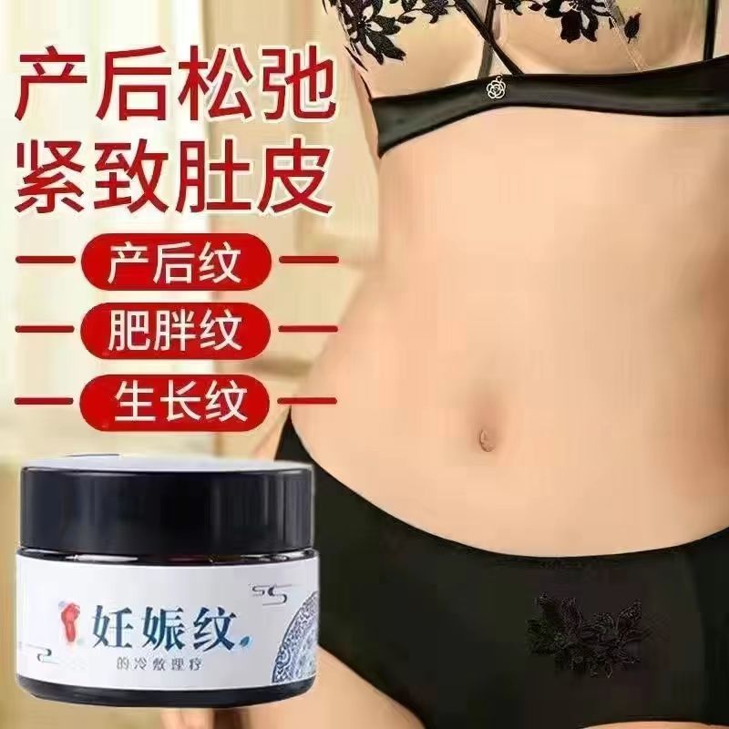 去妊娠纹产后修复霜 老婆去疤膏淡化强效肥胖纹修复膏大腿消除屁股胸纹 孕妇专用紧致肚皮产前预防消除生长纹