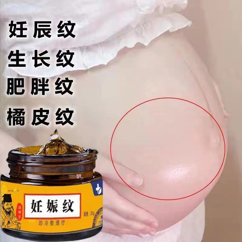 少妇去妊娠纹产后修复霜精油套装 孕妇专用淡化消除预防紧致肚皮祛肥胖纹生长纹 产后修复舒缓油祛妊娠纹