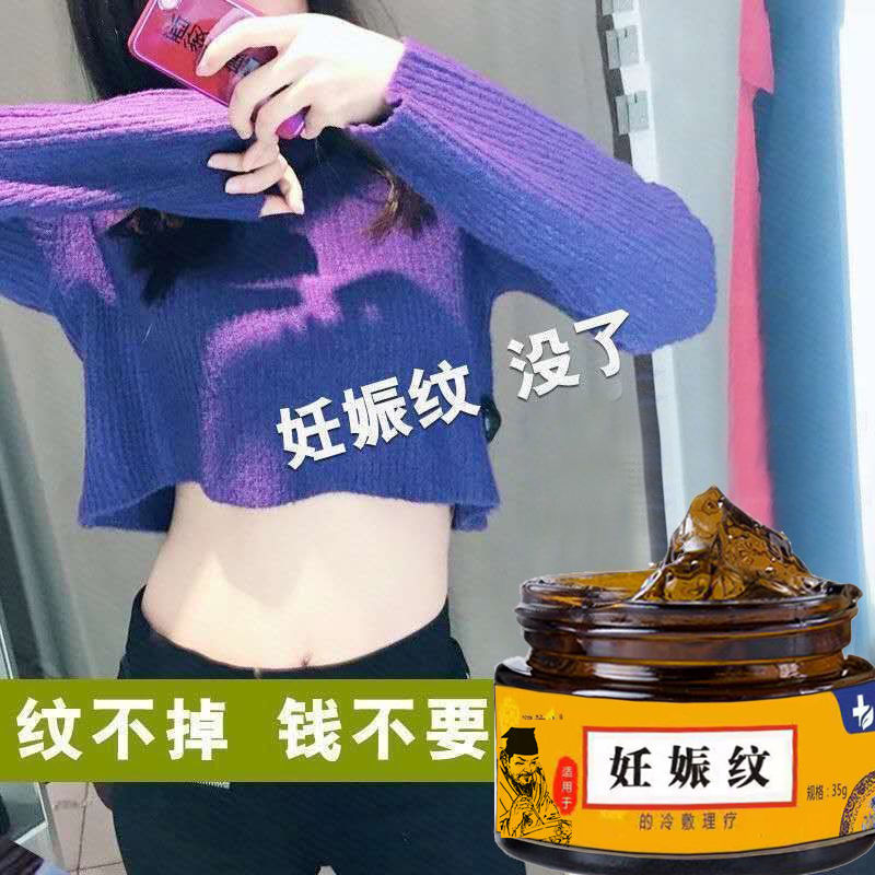 少妇去妊娠纹产后修复霜精油套装 孕妇专用淡化消除预防紧致肚皮祛肥胖纹生长纹 产后修复舒缓油祛妊娠纹