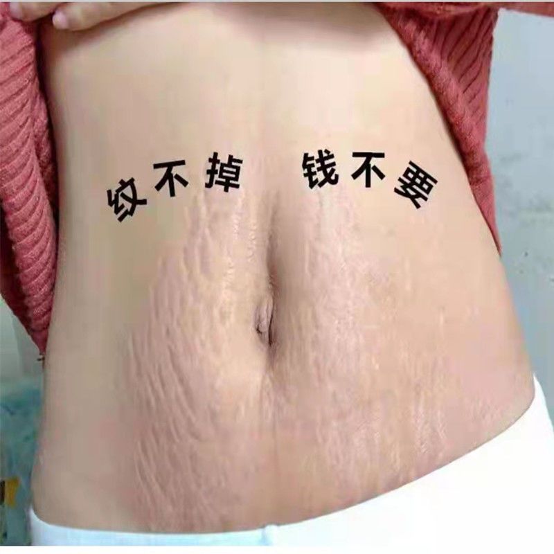 少妇去妊娠纹产后修复霜精油套装 孕妇专用淡化消除预防紧致肚皮祛肥胖纹生长纹 产后修复舒缓油祛妊娠纹