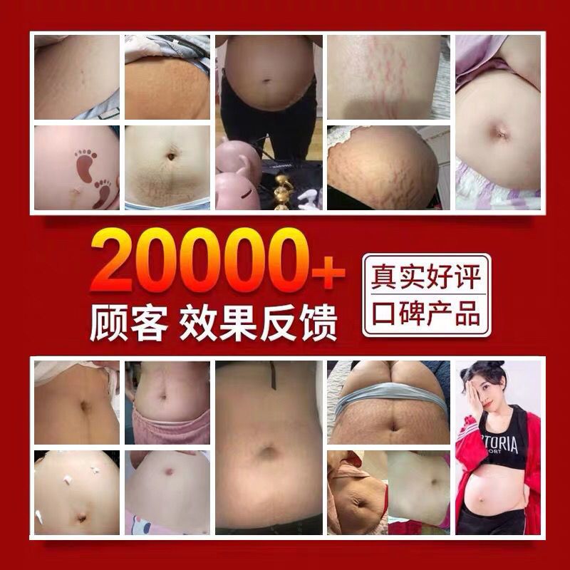 广药白云山去妊娠纹产后修复霜淡化紧致肚皮预防橄榄油 大腿纹怀孕期孕妇专用消除生长纹肥胖纹