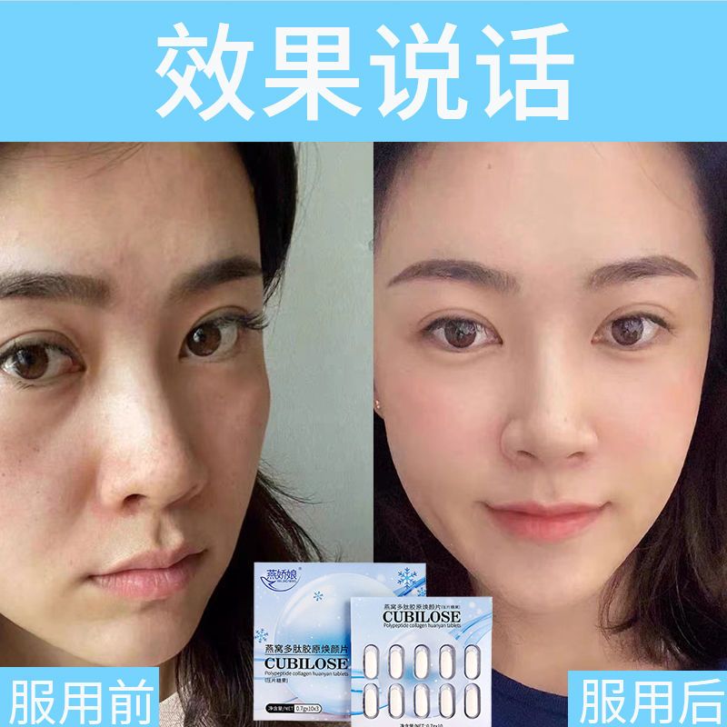 燕娇娘美白丸正品燕窝多肽胶原焕颜片压片糖果3盒90粒 口服进口美白丸改善肌肤祛斑提亮肤色 胶原蛋白肽去黄全身