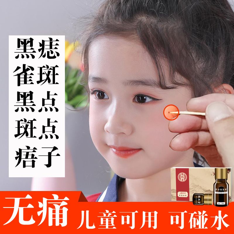 点痣药水祛痣祛斑膏无痕无痛脸部黑点去斑点斑去痣神器雀斑不留疤 点痣点斑水祛黑痣肉痣痦子斑点去痣神器永久