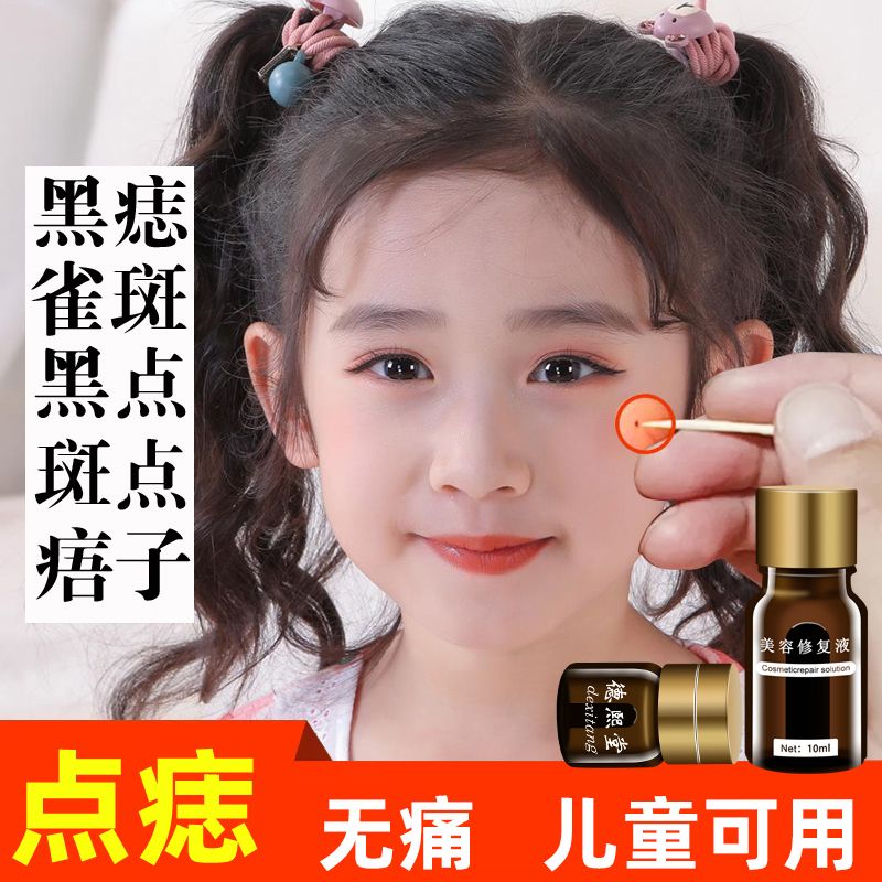 点痣药水祛痣祛斑膏无痕无痛脸部黑点去斑点斑去痣神器雀斑不留疤 点痣点斑水祛黑痣肉痣痦子斑点去痣神器永久