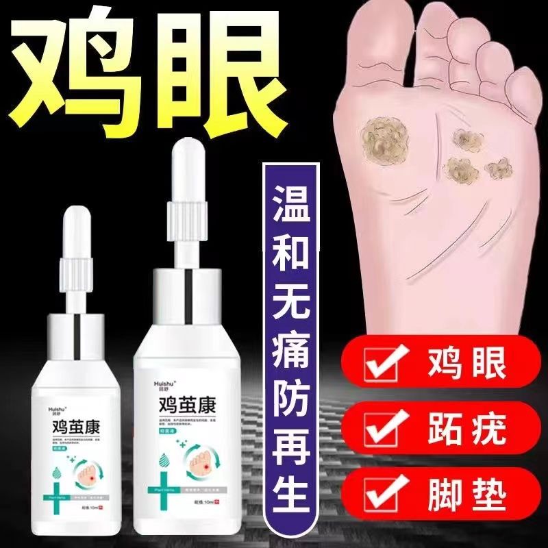 鸡眼专用膏鸡眼膏脚底祛老茧去除脚茧厚茧鸡眼祛肉刺猴子跖疣 无痛去老茧疣祛手足肉刺关节茧脚垫祛鸡眼贴手足