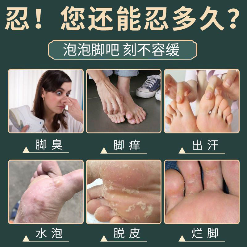 脚汗脚臭粉泡脚中药包去真菌止汗脚除臭脚克星 瑶辰足爽王抑菌足浴粉脚痒水泡脱皮烂脚丫