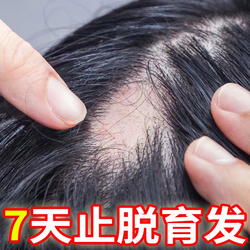 北京同仁堂洗发水生姜防脱育发增发密发控油去屑止痒蓬松 防脱育发生长液快速增发密发精华液护发防掉发秘造男女