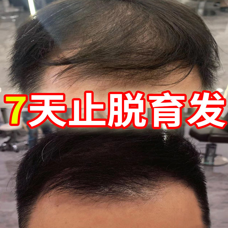 北京同仁堂洗发水生姜防脱育发增发密发控油去屑止痒蓬松 防脱育发生长液快速增发密发精华液护发防掉发秘造男女