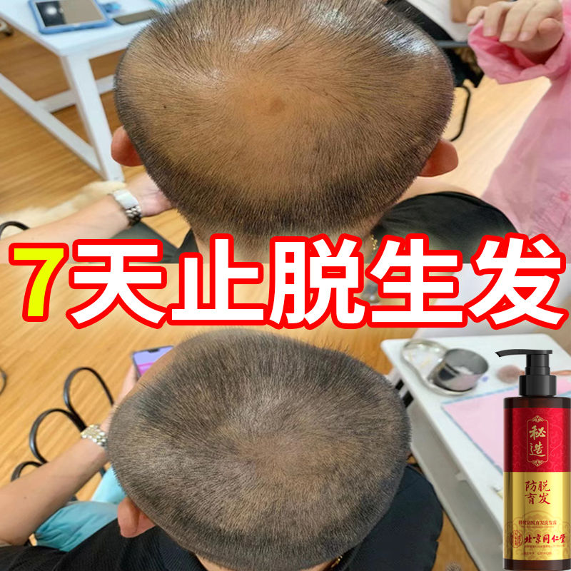 北京同仁堂洗发水生姜防脱育发增发密发控油去屑止痒蓬松 防脱育发生长液快速增发密发精华液护发防掉发秘造男女