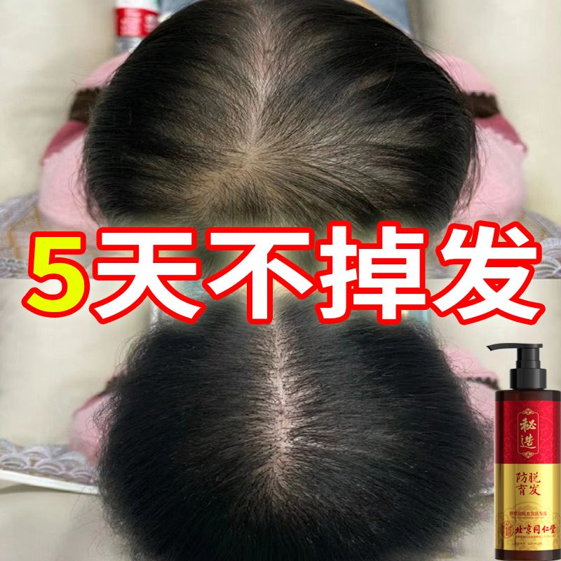 北京同仁堂洗发水生姜防脱育发增发密发控油去屑止痒蓬松 防脱育发生长液快速增发密发精华液护发防掉发秘造男女