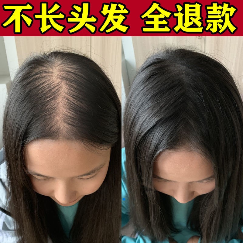 北京同仁堂洗发水生姜防脱育发增发密发控油去屑止痒蓬松 防脱育发生长液快速增发密发精华液护发防掉发秘造男女