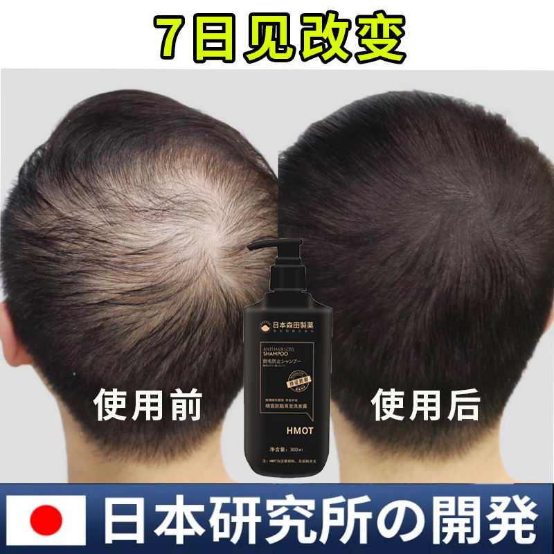 日本进口植物洗发水植物防脱养发增发去屑止痒清爽正品  发量增猛日本防脱育发滋养控油育发蓬松
