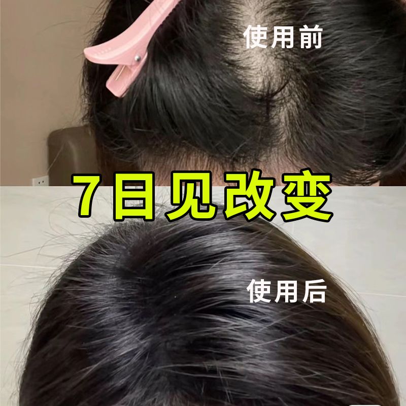 日本进口植物洗发水植物防脱养发增发去屑止痒清爽正品  发量增猛日本防脱育发滋养控油育发蓬松