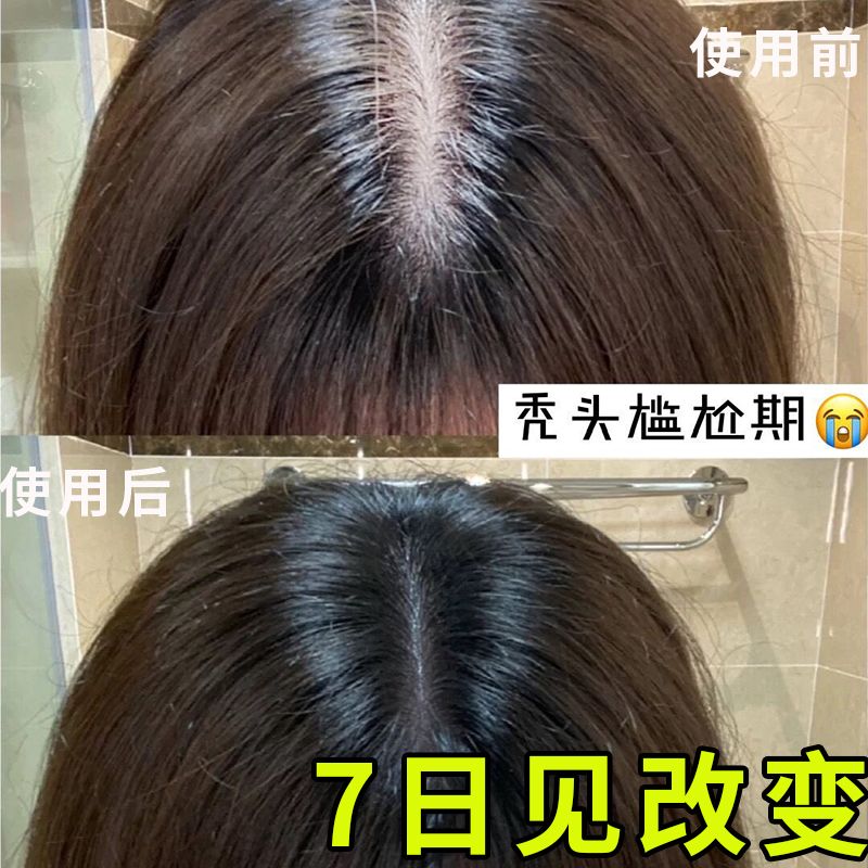 日本进口植物洗发水植物防脱养发增发去屑止痒清爽正品  发量增猛日本防脱育发滋养控油育发蓬松